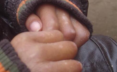 胳膊上米粒大小的白点会是白癜风吗