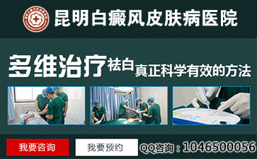 和白癜风握手传染吗