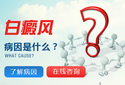 昆明白斑病治疗的费用